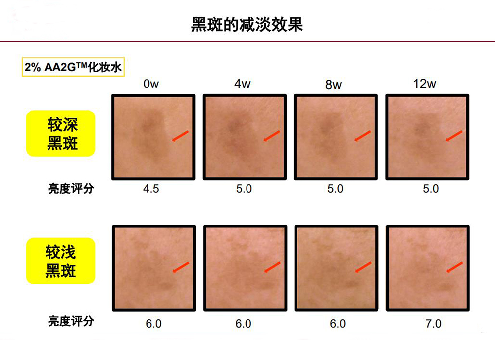 第一种材料:AA2G.jpg 第一种材料:AA2G.jpg