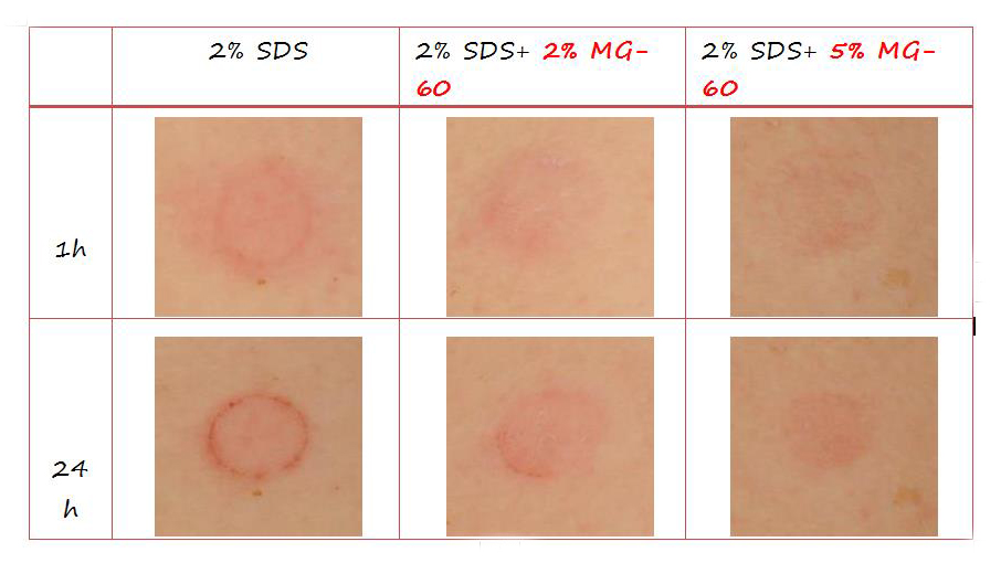 第四种原材料:MG60.jpg 第四种原材料:MG60.jpg