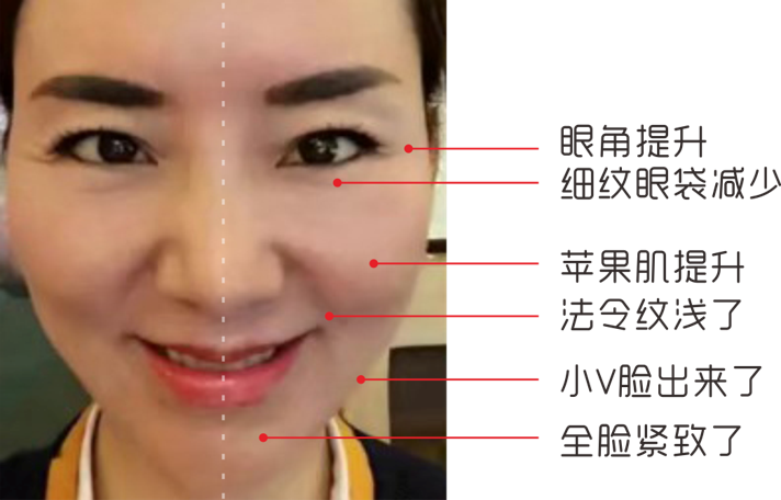 5.png 5.png